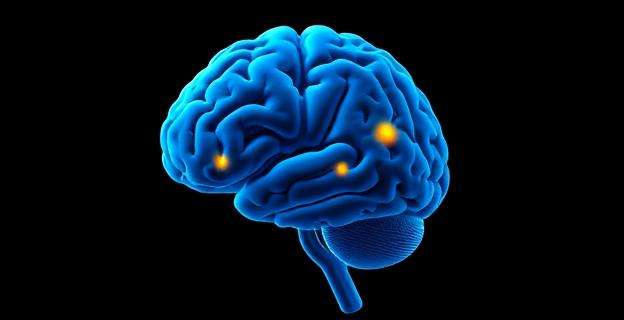 Imagen de una resonancia magnética cerebral mostrando actividad en el estriado ventral y la corteza prefrontal dorsomedial